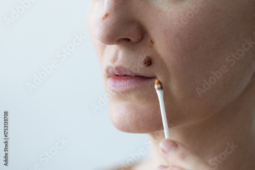 Slika na platnu Beauty spot above the lips