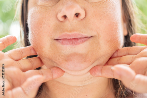 Photos close-up view facial skin, woman examines her fat neck, saggy chin with visible