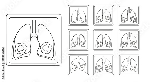 A detailed line drawing of lungs with various views and outlines on a white background in a medical illustration style.