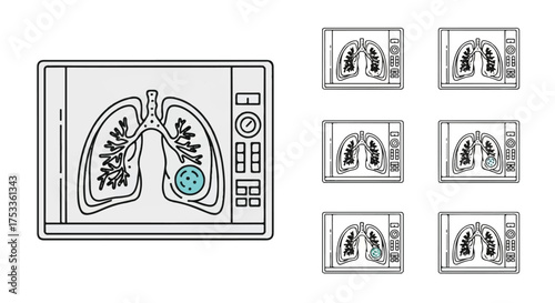 Medical illustration of lungs with a tumor on a computer screen surrounded by smaller images on a white background.