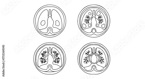 Four circular medical illustrations of human lungs in different cross-sectional views on a white background.