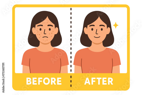 Before and after skincare transformation with clear complexion