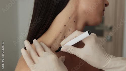 Mark up before Nefertiti lifting 4k video. Cosmetologist is drawing dotes before botulinum toxin injection in platysma of a woman. Improving neck by a professional. Female aesthetic cosmetology.