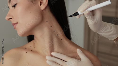 4k video cosmetologist is drawing dotes before botulinum toxin injection in platysma of a woman. Improving neck by a professional. Female aesthetic cosmetology. Mark up before Nefertiti lifting.