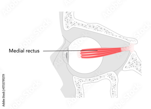 Medial rectus - Human eye muscle depicted in labeled anatomy chart, controls inward movement of the eyeball, critical in eye coordination and vision function education.
