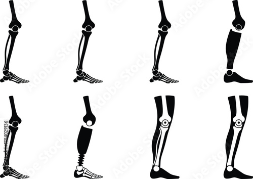 Human Leg Anatomy and Prosthetic Leg Illustrations