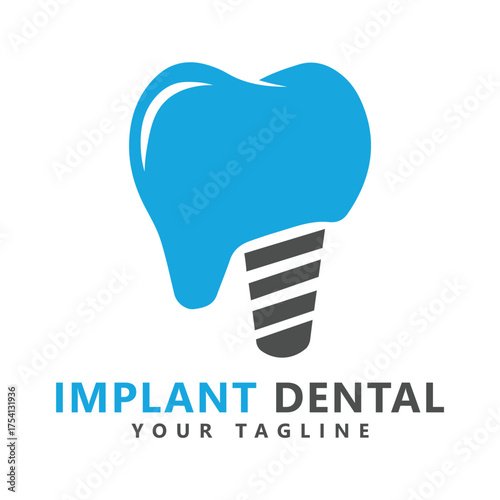 Implant dental logo template design vector, emblem, design concept, creative symbol, icon