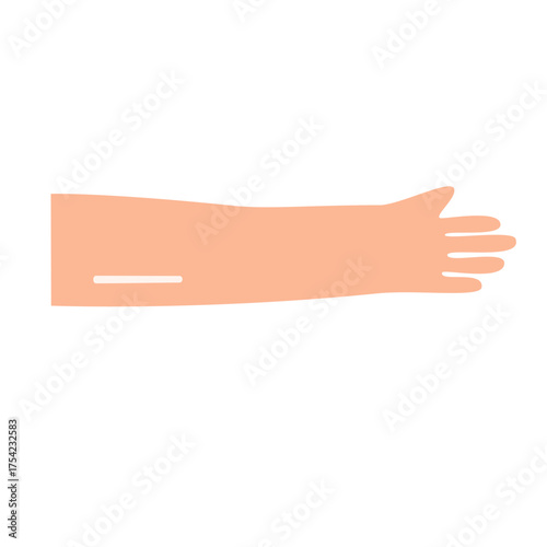 Implant contraception concept. vector illustration