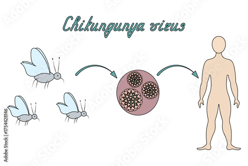 Chikungunya virus infection diagram. Cursive text. Mosquito - virus -human silhouette. Color vector illustration. Isolated on white background. Cartoon. Medical theme. Web design idea.