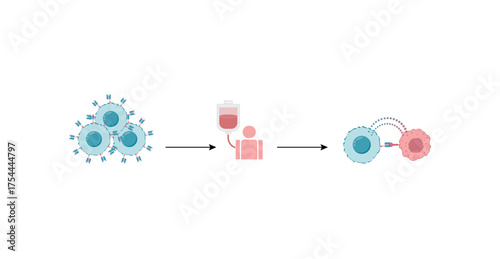 CAR T-cell therapy, killing of tumor cells. Cancer therapy. Chimeric antigen receptor T cell ,CAR T cell, for use in immunotherapy. Genetic engineering. Chemotherapy. Vector illustration.