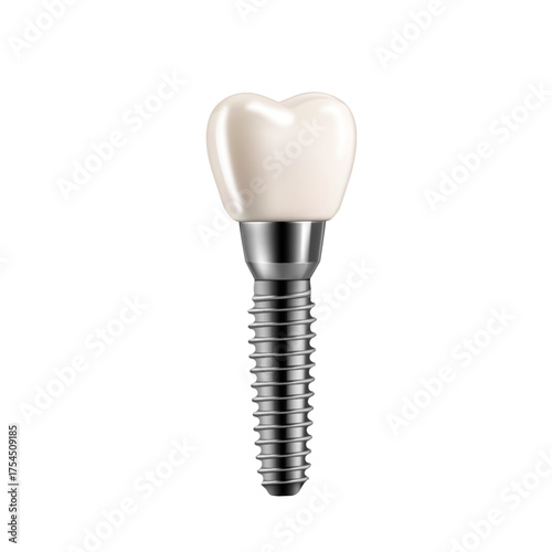 Dental implant on white. Realistic 3D illustration of titanium screw and ceramic crown for medical and professional use.
