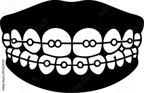 Silhouette of Orthodontic braces on teeth. Solid black Alignment of teeth with braces. Teeth with braces icon. Vector of Alignment of the bite of teeth, dentition with braces, dental braces.