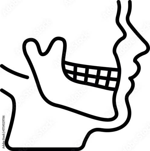 temporomandibular joint (TMJ). Anatomy of Temporomandibular Bone Structure. Anatomical Illustration of Temporomandibular Joint. TMD TMJ disorder