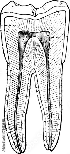 Tooth cross section. Human tooth internal anatomy cross section showing dental pulp and root canals medical illustration. Cross-section illustration of a tooth with pulpitis. 