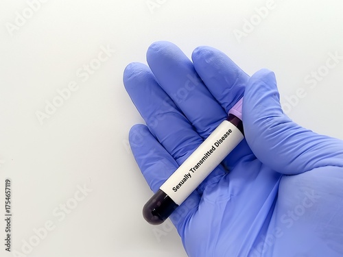 Doctor hold Blood sample for STD (Sexually Transmitted Disease) Test.