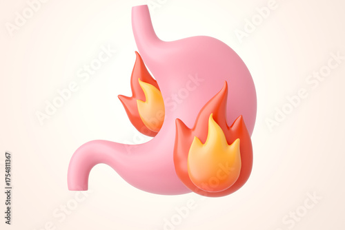 Gastritis and heartburn concept of a stomach on fire representing burning pain and inflammation 3D render