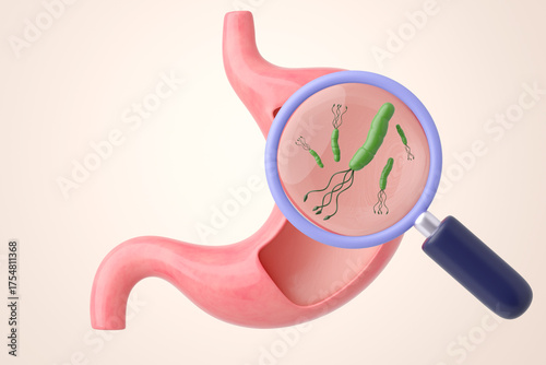 H Pylori bacteria diagnosis with a magnifying glass discovering an infection in the stomach 3D illustration