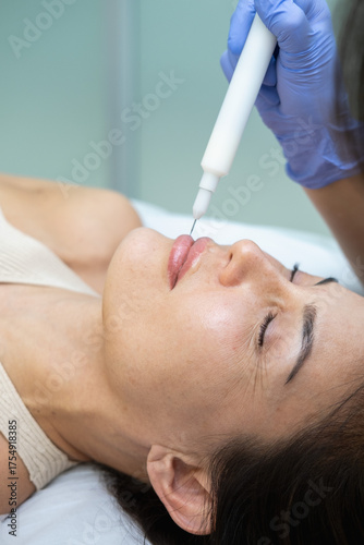 Canvastavla A cold plasma or non-equilibrium plasm for skincare