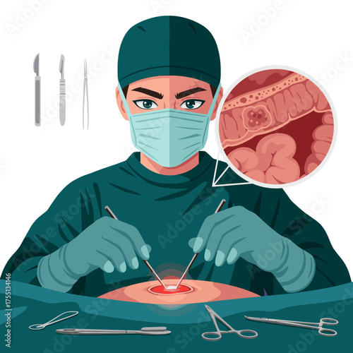 Attentive surgeon performing crucial colon cancer surgery with focus and precision for patient's health and well being during this life saving procedure