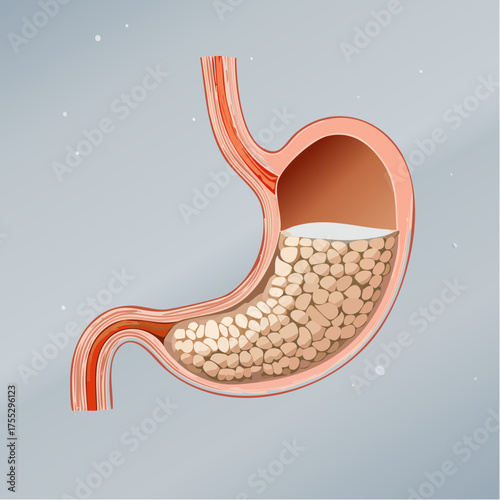 Anatomical illustration of the human stomach, showing its internal structure and contents.