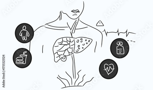 Non-alcoholic fatty liver disease risk factors