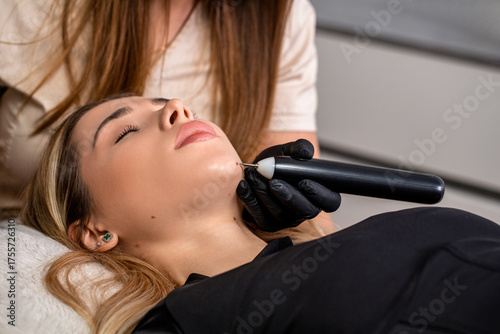 Canvas Print Skin mole removal