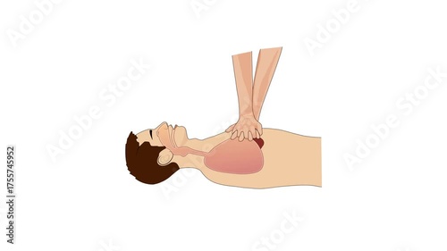 2D animation of CPR chest compressions showing medical resuscitation technique for training, safety, and emergency education