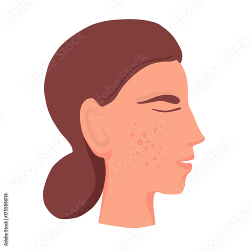 Female face profile with acne,  pimples vector illustration hand drawn