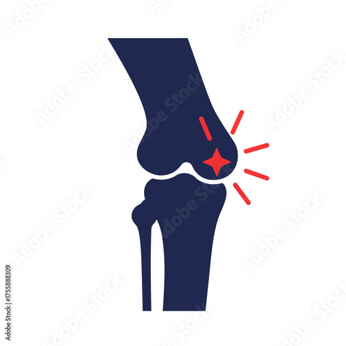 This graphic illustration depicts a human knee joint experiencing significant pain and inflammation, highlighted by a vibrant red starburst, symbolizing discomfort and medical conditions.