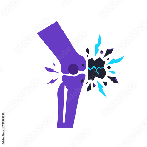 A graphic illustration depicting a painful knee injury with shattering bone and electric blue pain signals, symbolizing joint damage or arthritis.