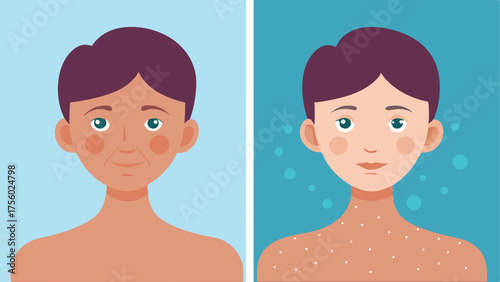 Before and After Skin Two sidebyside skin textures the left shows dull sagging skin while the right shows plump firm skin after exosome treatment enhancing elastin.