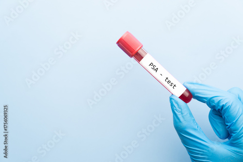 Blood sample tube with PSA test on medical laboratory technologist hands over blue background. A blood test that measures the level of prostate specific antigen to screen for prostate cancer.
