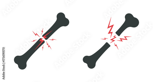Bone fracture illustration set isolated on white background vector design, vector illustration