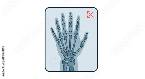 Radiographic illustration revealing human hand skeleton structure and medical diagnosis