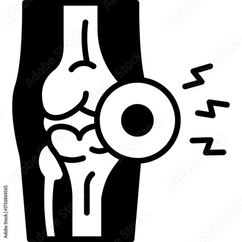 Arthritis Solid Icon