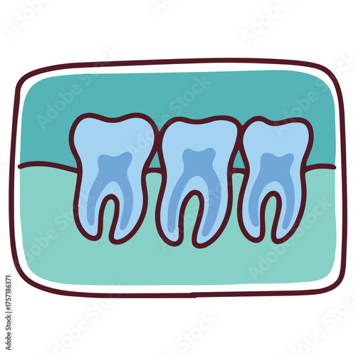A dental X-ray image showing several teeth, their roots, and the surrounding jawbone. This radiograph is a crucial diagnostic tool for dentists to assess oral health and identify underlying issues.