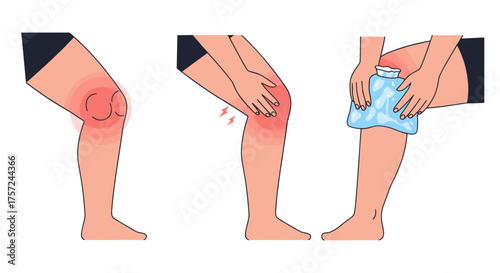 Illustration of knee pain stages with injury and ice pack  