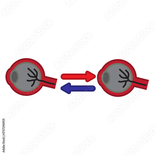 Eye Transplant