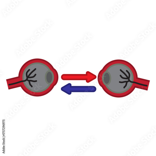 Eye Transplant
