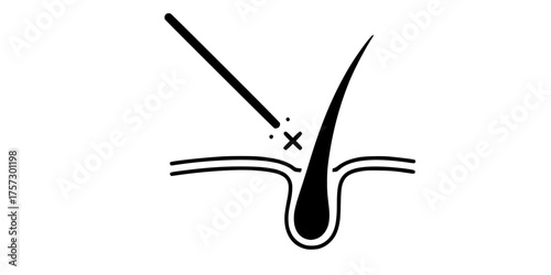 Laser Beam Hair Follicle Removal Flat Vector Graphic