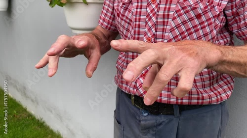 Close-up of elderly caucasian man doing finger and hand exercises: fist clenching and hand opening and thumb-to-finger touching. Hands with signs of rheumatoid arthritis and arthrosis.