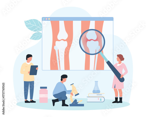Degenerative cartilage disease in knee joint, rheumatoid arthritis and osteoarthritis vector illustration. Cartoon tiny people with magnifying glass examine x ray of knee with gonarthrosis and pain