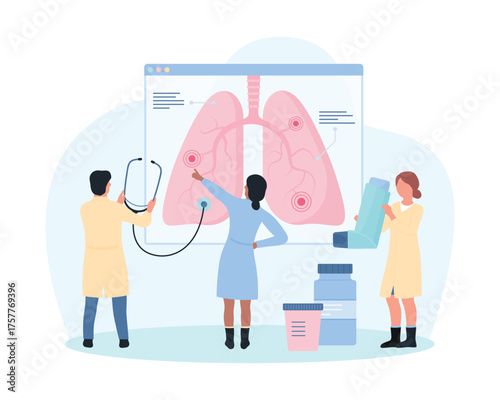 Study of lung diseases, pulmonology vector illustration. Cartoon tiny doctors or students with stethoscope analyzing detailed infographic anatomy chart with human organ, people research lungs