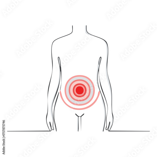 Abdominal Pain Illustration on Female Torso Depicts Gynecological Symptoms and Common Illnesses