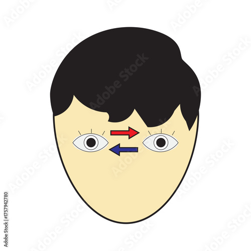 Eye Transplant