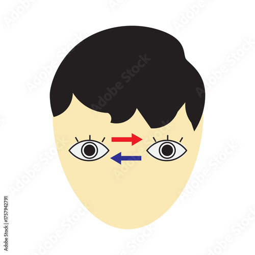 Eye Transplant