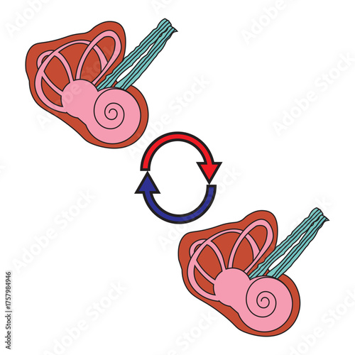 Cochlea Implant 