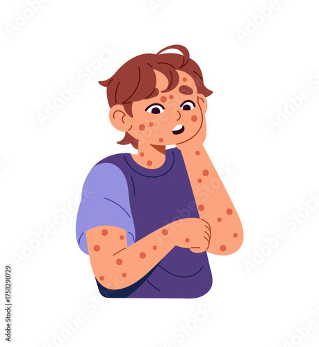 Ill boy with rash on body, chickenpox. Shocked kid is sick with measles, chicken pox, smallpox virus. Child with allergic red spots on skin. Flat isolated vector illustration on white background.