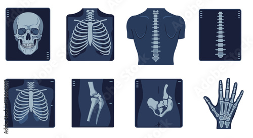 Medical x-ray collection: skeleton, spine, skull, ribs, hand, hip, leg
