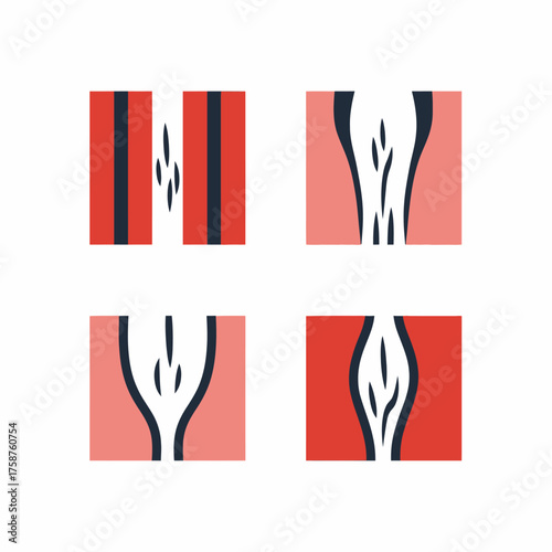 Medical vector icons of atherosclerosis and thrombosis conditions.
